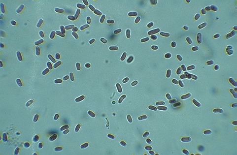 Baktériumok mikroszkóp alatt