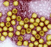 Calici - a leggyakrabban hasmenést okozó vírusok egyike