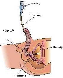 Cisztoszkópia