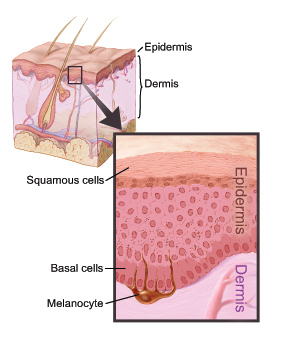 Dermis