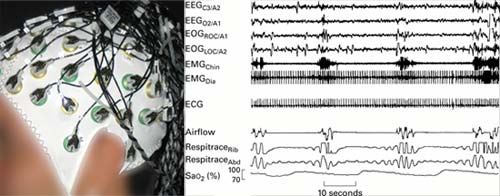 EEG