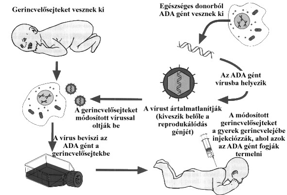 Génterápia - a kóros génszakaszok kicserélése