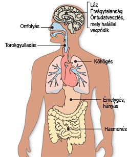 A H1N1 tünetei