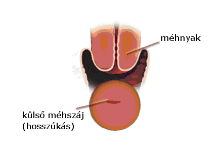 Külső méhszáj