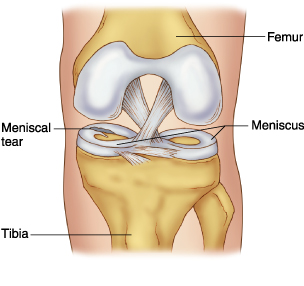 Meniscus