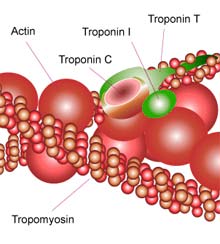 Troponin